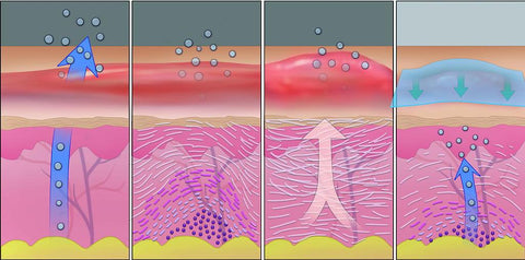 Understanding The 4 Stages Of Wound Healing